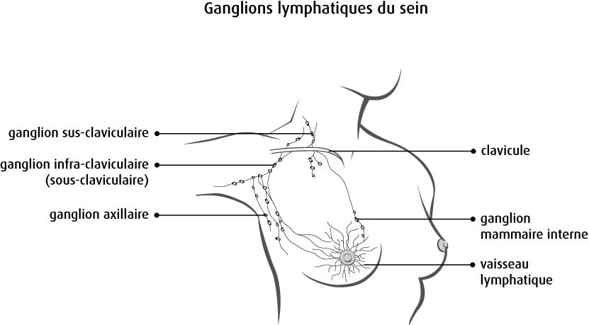 Repérage scintigraphique du ganglion sentinelle | Nucleanord